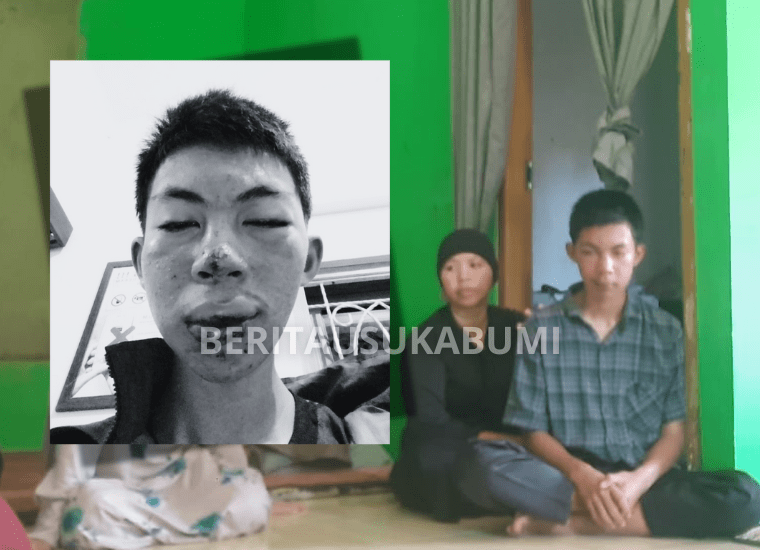 Video viral di Sukabumi memperlihatkan pelajar SMA 16 tahun di Cikidang menjadi korban salah sasaran pengeroyokan warga. Korban diikat, diseret, dan dipukuli hingga babak belur, padahal bukan pelaku. Keluarga menuntut polisi mengusut tuntas kasus main hakim sendiri ini.