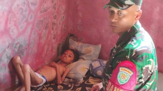 Gerak cepat TNI, Dandim Sukabumi bawa anak penderita gizi buruk ke rumah sakit setelah kondisinya kritis akibat dehidrasi dan TBC.